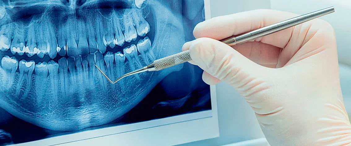 Ренген зубів